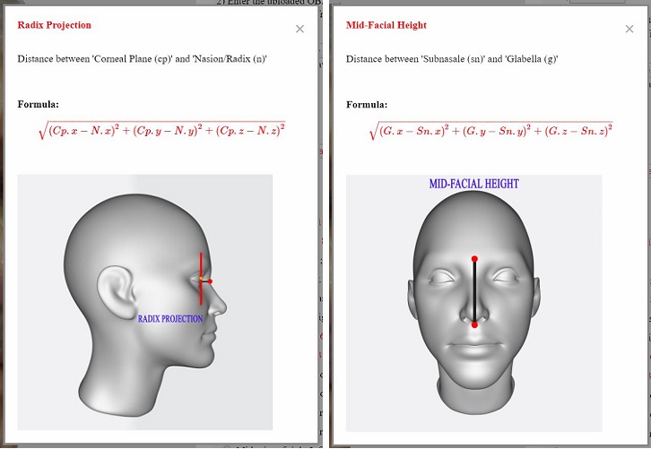 Radix Depth & Mid-Facial Height Details